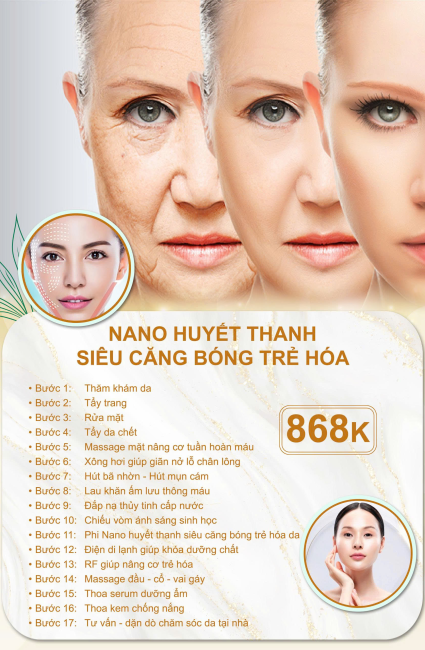 Bảng 4