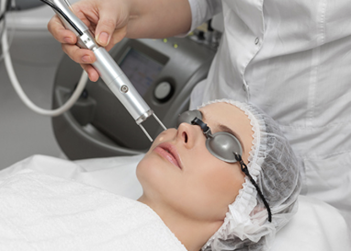 Máy laser trị nám